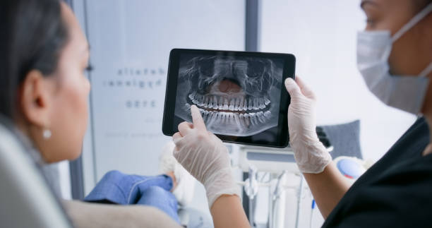 Licensed Teeth Whitening service in Mitchell, NE - Smile Center Dentistry